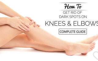 How To Get Rid Of Dark Elbows and Knees!