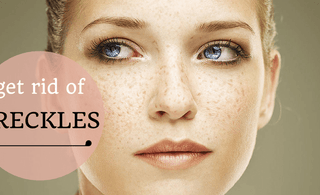 Get Rid Of Freckles In No Time!